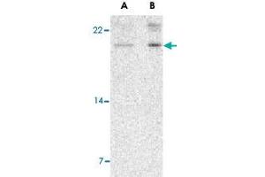 Western blot analysis of AES in 293 cell lysate with AES polyclonal antibody  at (A) 2 and (B) 4 ug/mL . (AES 抗体  (N-Term))