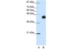 Cytokeratin 18 antibody used at 1. (Cytokeratin 18 抗体  (N-Term))