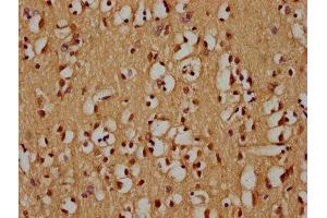 IHC image of ABIN7176072 diluted at 1:300 and staining in paraffin-embedded human brain tissue performed on a Leica BondTM system. (ZIM2 抗体  (AA 1-124))