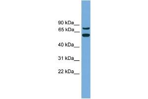 WB Suggested Anti-YY1AP1  Antibody Titration: 0. (YY1AP1 抗体  (Middle Region))