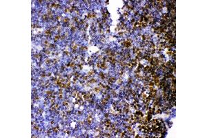 Anti- MCAK antibody, IHC(P) IHC(P): Rat Thymus Tissue