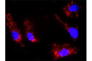 Proximity Ligation Analysis of protein-protein interactions between IL21 and DGKA. (IL-21 抗体  (AA 1-162))
