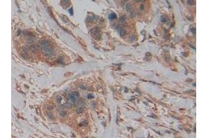 Immunohistochemistry (IHC) image for anti-Pyruvate Kinase M2 (PKM2) (AA 141-248) antibody (ABIN7432133)