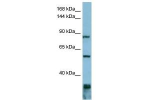 Western Blotting (WB) image for anti-Epidermal Growth Factor Receptor Pathway Substrate 8 (EPS8) (Middle Region) antibody (ABIN2785852)