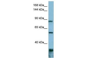 WB Suggested Anti-EPS8 Antibody Titration: 0. (EPS8 抗体  (Middle Region))