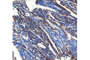 IHC analysis of CPT2/CPT1 using anti-CPT2/CPT1 antibody (ABIN7601357).