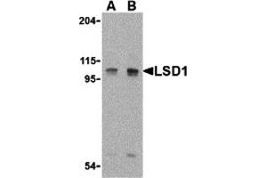 Western Blotting (WB) image for anti-Lysine (K)-Specific Demethylase 1A (KDM1A) (Middle Region) antibody (ABIN1030990) (LSD1 抗体  (Middle Region))