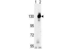 Western blot analysis of CSF1R antibody and 293 cell lysate (2 ug/lane) either nontransfected (Lane 1) or transiently transfected with the CSF1R gene (2).