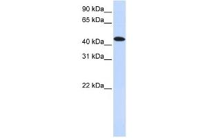 MKNK2 antibody used at 1 ug/ml to detect target protein. (MKNK2 抗体  (N-Term))