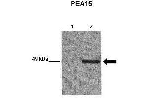 WB Suggested Anti-PEA15 Antibody  Positive Control: Lane 1:241 µg EGFP-transfected MCF7 lysate Lane 2: 041 µg EGFP-PEA15 transfected MCF7 lysate Primary Antibody Dilution: 1:0000Secondary Antibody: Goat anti-rabbit-HRP Secondry  Antibody Dilution: 1:0000Submitted by: Yann Wallez (Sanford-Burnham Medical Research Institute) (PEA15 抗体  (C-Term))