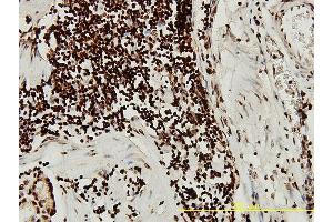 Immunoperoxidase of monoclonal antibody to SGK on formalin-fixed paraffin-embedded human stomach tissue. (SGK1 抗体  (AA 1-431))