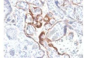 Formalin-fixed, paraffin-embedded human placenta stained with hCG beta Rabbit Recombinant Monoclonal Antibody (HCGb/1985R). (Recombinant CGB 抗体)