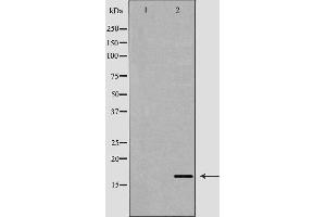 Western blot analysis of extracts of mouse spleen , using AIF1 antibody. (Iba1 抗体  (C-Term))