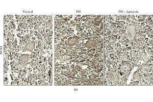 Immunohistochemistry (IHC) image for anti-NADPH Oxidase 1 (NOX1) antibody (ABIN2855720)