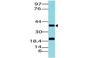 Image no. 1 for anti-Paired Box 5 (PAX5) (AA 102-339) antibody (ABIN5027430) (PAX5 抗体  (AA 102-339))