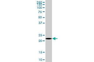 HEMK2 MaxPab polyclonal antibody. (N6AMT1 抗体  (AA 1-186))
