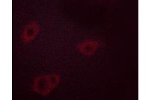 Immunofluorescence (fixed cells) (IF/ICC) image for anti-Heat Shock Protein 90kDa alpha (Cytosolic), Class B Member 1 (HSP90AB1) (pSer254) antibody (ABIN6255132)
