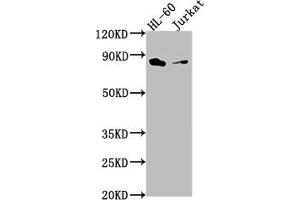 Western Blot Positive WB detected in: HL-60 whole cell lysate, Jurkat whole cell lysate All lanes: ELMO1 antibody at 1:2000 Secondary Goat polyclonal to rabbit IgG at 1/50000 dilution Predicted band size: 84, 29, 50 kDa Observed band size: 84 kDa (ELMO1 抗体  (AA 520-727))
