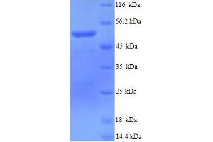SDS-PAGE (SDS) image for Lysyl Oxidase-Like 1 (LOXL1) (AA 95-607) protein (His tag) (ABIN5713614)