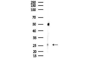 anti-Motile Sperm Domain Containing 3 (MOSPD3) antibody