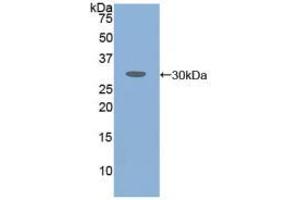 Western blot analysis of recombinant Human ATXN1. (Ataxin 1 抗体  (AA 569-807))