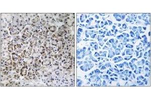 Immunohistochemistry analysis of paraffin-embedded human pancreas tissue, using MRPL40 Antibody.