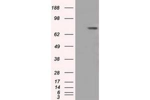 Western Blotting (WB) image for anti-Bruton Agammaglobulinemia tyrosine Kinase (BTK) antibody (ABIN1496975) (BTK 抗体)
