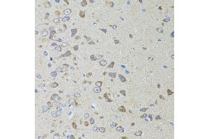 Immunohistochemistry of paraffin-embedded rat brain using AIFM3 antibody (ABIN5996156) at dilution of 1/100 (40x lens). (AIFM3 抗体)