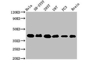Western Blot Positive WB detected in: Hela whole cell lysate, SH-SY5Y whole cell lysate, 293T whole cell lysate, U87 whole cell lysate, PC-3 whole cell lysate, Rat brain tissue All lanes: KTI12 antibody at 3. (KTI12 抗体  (AA 110-204))