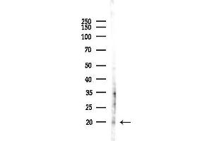 anti-Mitochondrial Ribosomal Protein L17 (MRPL17) (Internal Region) antibody