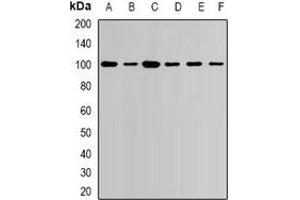 Western blot analysis of USP16 expression in Jurkat (A), NIH3T3 (B), COS7 (C), mouse heart (D), mouse spleen (E), rat brain (F) whole cell lysates. (USP16 抗体)