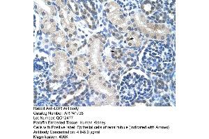 Rabbit Anti-LOR Antibody  Paraffin Embedded Tissue: Human Kidney Cellular Data: Epithelial cells of renal tubule Antibody Concentration: 4. (LOR 抗体  (N-Term))