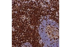 Immunohistochemical staining of human tonsil with FYB polyclonal antibody ( Cat # PAB28030 ) shows strong cytoplasmic positivity at 1:50 - 1:200 dilution. (FYB 抗体)