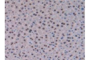 IHC-P analysis of Mouse Liver Tissue, with DAB staining. (GCKR 抗体  (AA 17-261))