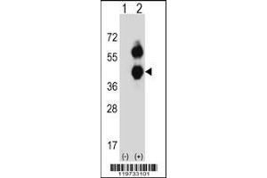 Western blot analysis of BCAT2 using rabbit polyclonal BCAT2 Antibody using 293 cell lysates (2 ug/lane) either nontransfected (Lane 1) or transiently transfected (Lane 2) with the BCAT2 gene. (BCAT2 抗体  (C-Term))