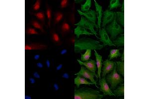 ABIN6257563 and ABIN6274180 staining  cells by IF/ICC. (ZNF24 抗体  (Internal Region))