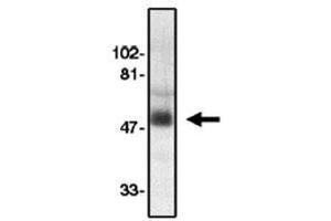 Image no. 1 for anti-Chemokine (C-C Motif) Receptor 8 (CCR8) (AA 183-201), (Extracellular Loop) antibody (ABIN265001) (CCR8 抗体  (Extracellular Loop))
