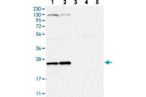 Western blot analysis of Lane 1: RT-4, Lane 2: U-251 MG, Lane 3: Human Plasma, Lane 4: Liver, Lane 5: Tonsil with ARL4C polyclonal antibody  at 1:250-1:500 dilution. (ARL4C 抗体)