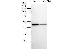 Western Blotting (WB) image for anti-ATPase, Na+/K+ Transporting, beta 1 Polypeptide (ATP1B1) antibody (ABIN7606956)