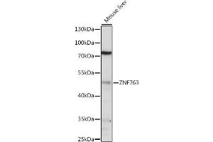 Western blot analysis of extracts of various cell lines, using ZNF763 antibody (ABIN7271529) at 1:1000 dilution. (ZNF763 抗体  (AA 315-370))