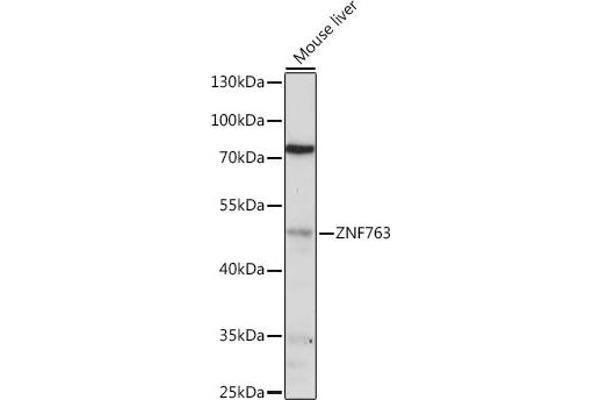 ZNF763 Antikörper  (AA 315-370)