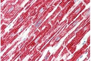 Human Heart: Formalin-Fixed, Paraffin-Embedded (FFPE) (SRR 抗体)