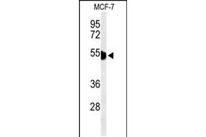 Western blot analysis of KRT1 Antibody in MCF-7 cell line lysates (35ug/lane) (Cytokeratin 1 抗体  (AA 415-443))