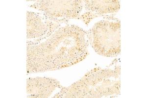Immunohistochemistry (Paraffin-embedded Sections) (IHC (p)) image for anti-Rap Guanine Nucleotide Exchange Factor (GEF) 5 (RAPGEF5) antibody (ABIN7075365)