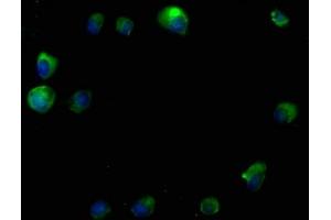 Immunofluorescence staining of MCF-7 cells with ABIN7140114 at 1:50, counter-stained with DAPI. (RTN4RL2 抗体  (AA 355-372))