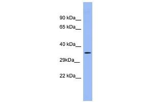 PSG5 antibody used at 1 ug/ml to detect target protein. (PSG5 抗体  (Middle Region))