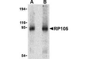 Western Blotting (WB) image for anti-CD180 Molecule (CD180) (Middle Region) antibody (ABIN1031073) (CD180 抗体  (Middle Region))