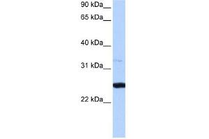 PRTFDC1 antibody used at 0. (PRTFDC1 抗体  (Middle Region))