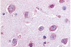 Human Brain, Cortex (formalin-fixed, paraffin-embedded) stained with P2RY8 antibody ABIN213464 at 20 ug/ml followed by biotinylated goat anti-rabbit IgG secondary antibody ABIN481713, alkaline phosphatase-streptavidin and chromogen. (P2RY8 抗体  (C-Term))