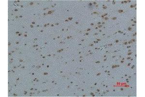 Immunohistochemistry (IHC) image for anti-Calcium Channel, Voltage-Dependent, gamma Subunit 4 (CACNG4) antibody (ABIN7189157)